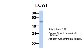 LCAT Rabbit Polyclonal Antibody