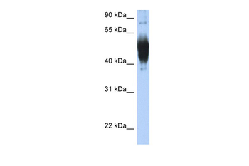 LCAT Rabbit Polyclonal Antibody