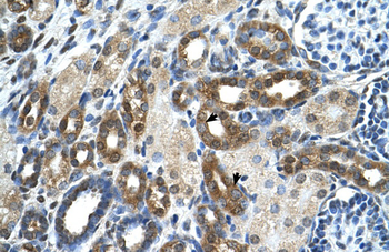 PKLR Rabbit Polyclonal Antibody