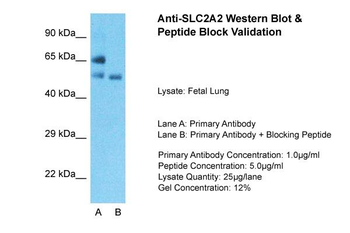 SLC2A2 Rabbit Polyclonal Antibody