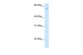 SLC2A2 Rabbit Polyclonal Antibody
