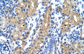 HSD17B1 Rabbit Polyclonal Antibody