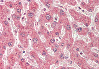 KRT19 Rabbit Polyclonal Antibody