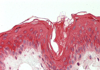 KRT19 Rabbit Polyclonal Antibody