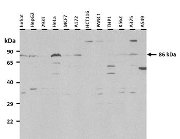SLC26A4 Rabbit Polyclonal Antibody