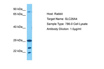 SLC26A4 Rabbit Polyclonal Antibody