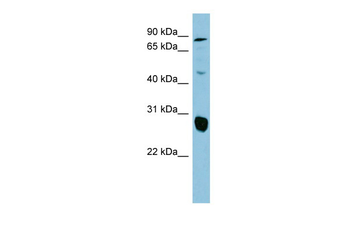 SLC26A4 Rabbit Polyclonal Antibody