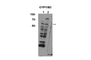 CYP11B2 Rabbit Polyclonal Antibody