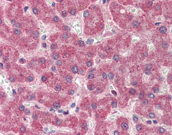 F2 Rabbit Polyclonal Antibody