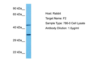 F2 Rabbit Polyclonal Antibody