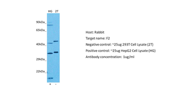 F2 Rabbit Polyclonal Antibody