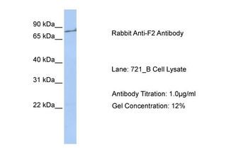 F2 Rabbit Polyclonal Antibody