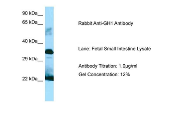 GH1 Rabbit Polyclonal Antibody