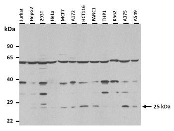 GH1 Rabbit Polyclonal Antibody