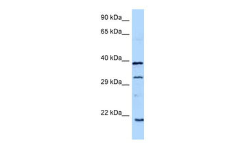 GH1 Rabbit Polyclonal Antibody