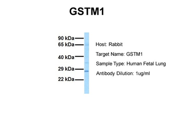 GSTM1 Rabbit Polyclonal Antibody