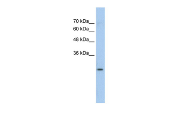 GSTM1 Rabbit Polyclonal Antibody