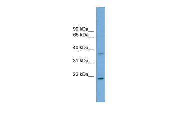 GSTM1 Rabbit Polyclonal Antibody