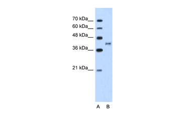 BDKRB2 Rabbit Polyclonal Antibody