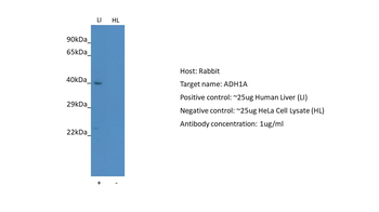 ADH1A Rabbit Polyclonal Antibody