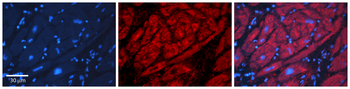 ADH1B Rabbit Polyclonal Antibody