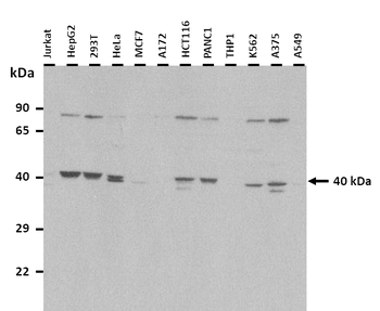 ADH1B Rabbit Polyclonal Antibody