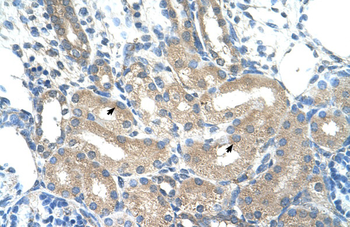 ADH1B Rabbit Polyclonal Antibody