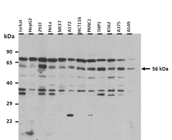 CYP2B6 Rabbit Polyclonal Antibody