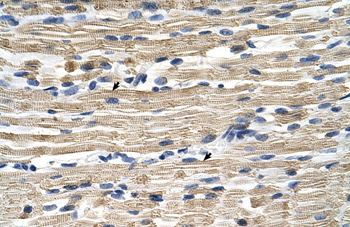 GSTM2 Rabbit Polyclonal Antibody