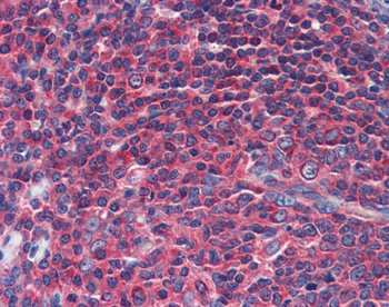 NPY1R Rabbit Polyclonal Antibody