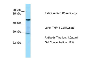 KLK3 Rabbit Polyclonal Antibody
