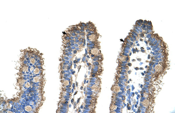 RHOBTB1 Rabbit Polyclonal Antibody