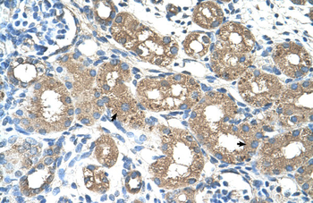 ALAS2 Rabbit Polyclonal Antibody