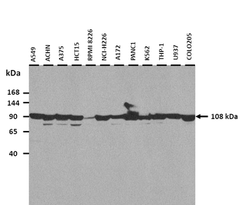 ACTN3 Rabbit Polyclonal Antibody