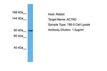 ACTN3 Rabbit Polyclonal Antibody