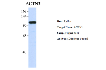ACTN3 Rabbit Polyclonal Antibody