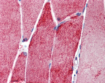 ACTN3 Rabbit Polyclonal Antibody