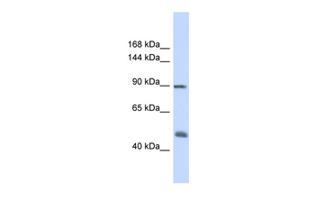 ACTN1 Rabbit Polyclonal Antibody