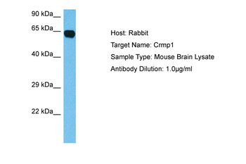 CRMP1 Rabbit Polyclonal Antibody
