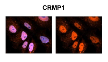 CRMP1 Rabbit Polyclonal Antibody