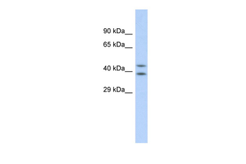DHODH Rabbit Polyclonal Antibody