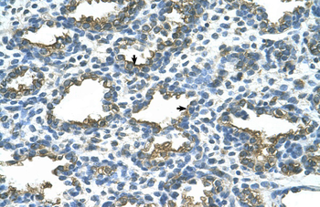 ALPP Rabbit Polyclonal Antibody