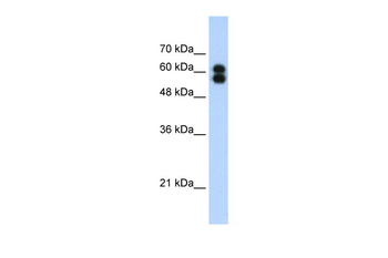 ALPP Rabbit Polyclonal Antibody