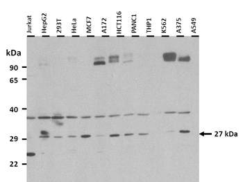 BDNF Rabbit Polyclonal Antibody