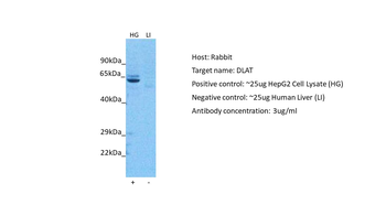 DLAT Rabbit Polyclonal Antibody