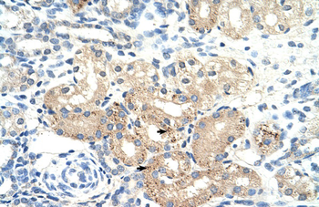 DLAT Rabbit Polyclonal Antibody