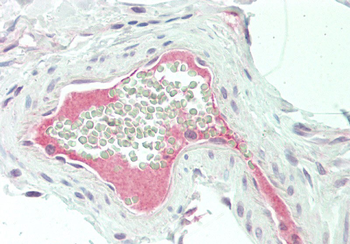 F13B Rabbit Polyclonal Antibody