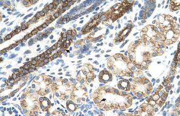 KRT8 Rabbit Polyclonal Antibody