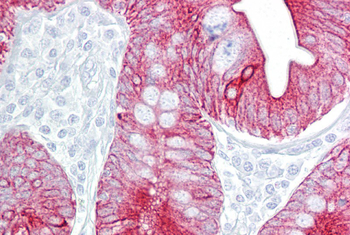 KRT8 Rabbit Polyclonal Antibody