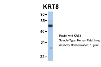 KRT8 Rabbit Polyclonal Antibody